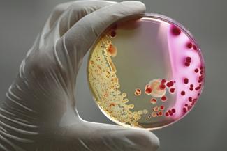 Organisms in a petri dish